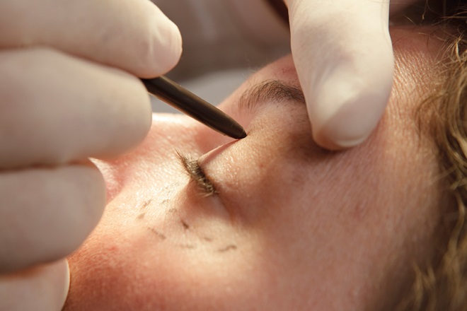 Our cosmetic interventions guidance cover 